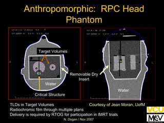 Target Volumes Critical Structure TLDs in Target Volumes Radiochromic film through multiple plans Delivery is required by RTOG for participation in IMRT trials Removable Dry Insert Water Water Anthropomorphic:  RPC Head Phantom Courtesy of Jean Moran, UofM 