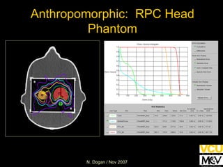 Anthropomorphic:  RPC Head Phantom 