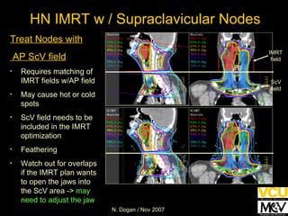 HN IMRT w / Supraclavicular Nodes Treat Nodes with AP ScV field Requires matching of IMRT fields w/AP field May cause hot or cold spots ScV field needs to be included in the IMRT optimization Feathering Watch out for overlaps if the IMRT plan wants to open the jaws into the ScV area ->  may need to adjust the jaw ScV field IMRT field 