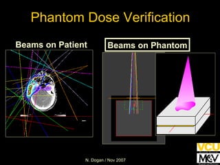 Phantom Dose Verification Beams on Patient Beams on Phantom 