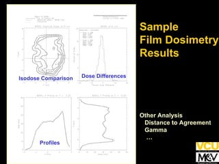 Sample Film Dosimetry  Results Other Analysis Distance to Agreement Gamma … Isodose Comparison Profiles Dose Differences 