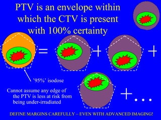 Imrt Where Next Image Guided Radiotherapy | PPT