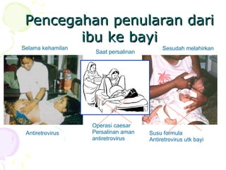 Pencegahan penularan dari
Pencegahan penularan dari
ibu ke bayi
ibu ke bayi
Selama kehamilan
Susu formula
Antiretrovirus utk bayi
Operasi caesar
Persalinan aman
antiretrovirus
Antiretrovirus
Saat persalinan
Sesudah melahirkan
 