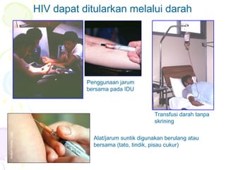 Holmes
HIV dapat ditularkan melalui darah
Transfusi darah tanpa
skrining
Penggunaan jarum
bersama pada IDU
BBC
News
online
Alat/jarum suntik digunakan berulang atau
bersama (tato, tindik, pisau cukur)
 