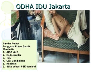 ODHA IDU Jakarta
ODHA IDU Jakarta
Bandar Putaw
Pengguna Putaw Suntik
Menderita :
1. AIDS std 3
2. Endocarditis
3. TBC
4. Oral Candidiasis
5. Hepatitis
6. Seks bebas, PSK dan Istri
 