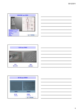 05/12/2011




                     MSOME και IMSI




6 Ενδοκυτταρικά στοιχεία
Ακρόσωμα
Ακροσωμική μεμβράνη
Αυχένας
Μιτοχόνδρια
Ουρά
Πυρήνας




                           ICSI και IMSI




                       ICSI και IMSI




             ICSI                      IMSI
             Hoffman                   Nomarski




                                                          4
 