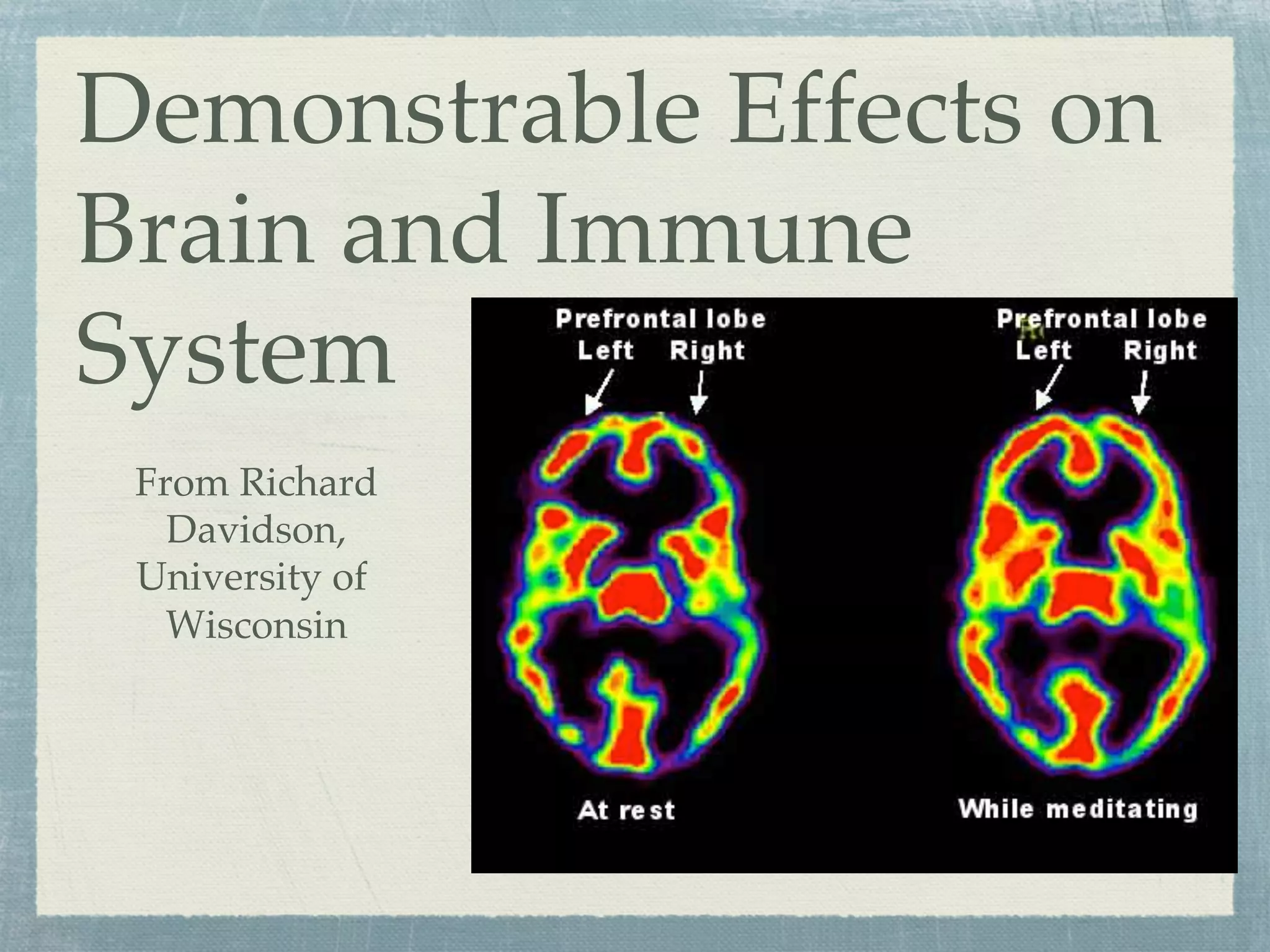 Demonstrable Effects on
Brain and Immune
System
From Richard
Davidson,
University of
Wisconsin
 