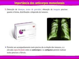 Ä Detecção de doenças, testes de gravidez, obtenção de imagens precisas
	
  quanto à forma, distribuição e dispersão de tumores.
	
  
	
  
	
  
	
  
	
  
	
  
	
  
	
  
	
  
	
  
	
  
	
  
	
  
	
  
	
  
	
  
	
  
	
  
	
  
	
  
	
  
	
  
	
  
	
  
	
  
	
  
	
  
	
  
	
  
	
  
« Permite um acompanhamento mais preciso da evolução dos tumores, e a
	
  elevada especificidade entre os anticorpos e os antigenes permite realizar
	
  testes precisos e fiáveis.
 