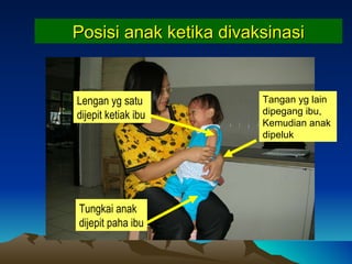 Posisi anak  ketika di vaksinasi Tungkai anak dijepit paha ibu Lengan yg satu dijepit ketiak ibu Tangan yg lain dipegang ibu,  Kemudian anak dipeluk 