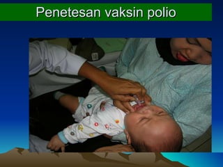 Penetesan   vaksin   polio 