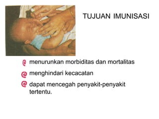 TUJUAN IMUNISASI




menurunkan morbiditas dan mortalitas
menghindari kecacatan
dapat mencegah penyakit-penyakit
tertentu.
 