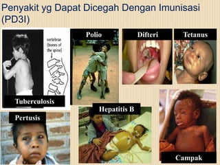 Penyakit yg Dapat Dicegah Dengan Imunisasi
(PD3I)
Polio

Difteri

Tetanus

Tuberculosis
Hepatitis B
Pertusis

Campak

 