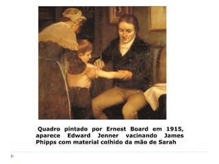 Quadro pintado por Ernest Board em 1915,
aparece Edward Jenner vacinando James
Phipps com material colhido da mão de Sarah
 