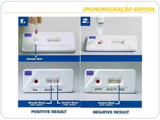 IMUNOMIGRAÇÃO RÁPIDAIMUNOMIGRAÇÃO RÁPIDA
 