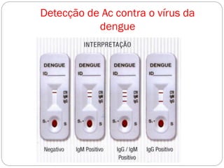 Detecção de Ac contra o vírus da
dengue
 