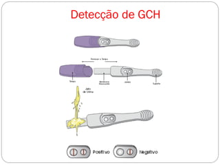 Detecção de GCH
 
