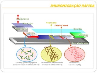 IMUNOMIGRAÇÃO RÁPIDAIMUNOMIGRAÇÃO RÁPIDA
 