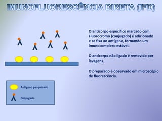 O anticorpo específico marcado com
Fluorocromo (conjugado) é adicionado
e se fixa ao antígeno, formando um
imunocomplexo estável.
O anticorpo não ligado é removido por
lavagens.
O preparado é observado em microscópio
de fluorescência.
Y Y
Y
Y
Y
Y
Y
Antígeno pesquisado
Conjugado
 