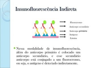 Imunofluorescência Indireta

                                       Fluorocromo
                                       Anticorpo secundário
                                       Anticorpo primário
                                       Antígeno
                                       Lâmina



 Nessa   modalidade de imunofluorescência,
 além do anticorpo primário é colocado um
 anticorpo secundário, e esse secundário
 anticorpo está conjugado a um fluorocromo,
 ou seja, o antígeno é detectado indiretamente.
 