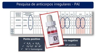 Pesquisa de anticorpos irregulares - PAI
Ponto positivo
 R1R1 e R2R2
 Fya Fyb Jka Jkb
 M S homozigose
Ponto negativo
 Dia positivo
 