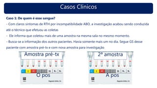 Casos Clínicos
Caso 1: De quem é esse sangue?
- Com claros sintomas de RTH por incompatibilidade ABO, a investigação acabou sendo conduzida
até o técnico que efetuou as coletas
- Ele informa que coletou mais de uma amostra na mesma sala no mesmo momento.
- Busca-se a informação dos outros pacientes. Havia somente mais um no dia. Segue GS desse
paciente com amostra pré-tx e com nova amostra para investigação
A posO pos
2ª amostraAmostra pré-tx
 