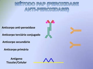 Secções HistológicasRecuperação AntigênciaBloqueio Enzima EndógenaBloqueio BackgroundAnticorpo Primário Anticorpo SecundárioSubstrato CromógenoCounterstainMontagemObservação (Microscopia)Slide 3 of 23PASSOS DA TÉCNICA