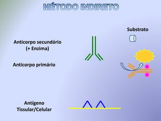 Antígeno
Tissular/Celular
Anticorpo primário
Anticorpo secundário
(+ Enzima)
Substrato
 