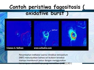 Contoh peristiwa fagositosis (
oxidative burst )
jamur
Penambahan indikator warna nitroblue tetrazolium
(NBT) menunjukkan bahwa sel leukosit tersebut
mampu membunuh jamur dengan menggunakan
kemampuan oksidatifnya yang mematikan ( H2O2,NO )
 