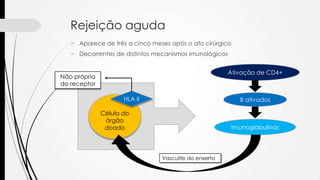 Rejeição aguda
 Aparece de três a cinco meses após o ato cirúrgico
 Decorrentes de distintos mecanismos imunológicos
Célula do
órgão
doado
HLA II
Não própria
do receptor
B ativados
Imunoglobulinas
Ativação de CD4+
Vasculite do enxerto
 