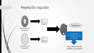 Rejeição aguda
Monócito do
receptor
Linfócitos do
receptor
IL-1
IL-12
IL-2
IFN-y
LT auxiliares 1
LT citotóxicos do
receptor
Vasculite e lise de
células do enxerto
Citocinas
 