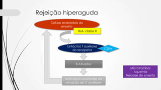 Rejeição hiperaguda
Células endoteliais do
enxerto
HLA- classe II
Linfócitos T auxiliares
do recepetor CD4+
B Ativados
Anticorpos resultantes da
ativação de LT auxiliares
Microtrombos
Isquemia
Necrose do enxerto
 