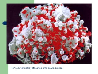 HIV (em vermelho) atacando uma célula branca

 