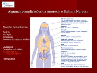 Algumas complicações da Anorexia e Bulimia Nervosa - Alterações Gastrointestinais Gastrite esofagite constipação  síndrome do intestino irritável Leucopenia   (leucócitos reduzidos) DAR ÊNFASE NA LEUCOPENIA!!!! - Hipoglicemia 