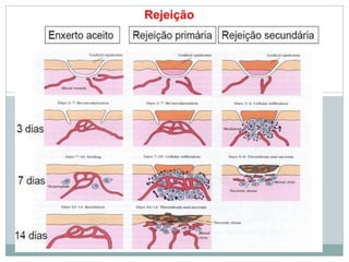 Rejeição
 