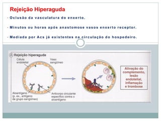 Rejeição Hiperaguda
• O c l u s ã o d a v a s c u l a t ur a d o e n x e r t o.
• M i n u t os o u h o r a s a p ó s a n a s t o m os e v a s o s e n x e r t o r e c e p t or.
• M e d i a da p o r A c s j á e x i s t e nt e s n a c i r c ul a ç ã o d o h o s p e d e i r o.
 