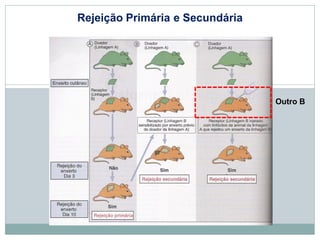 Rejeição Primária e Secundária
Outro B
 