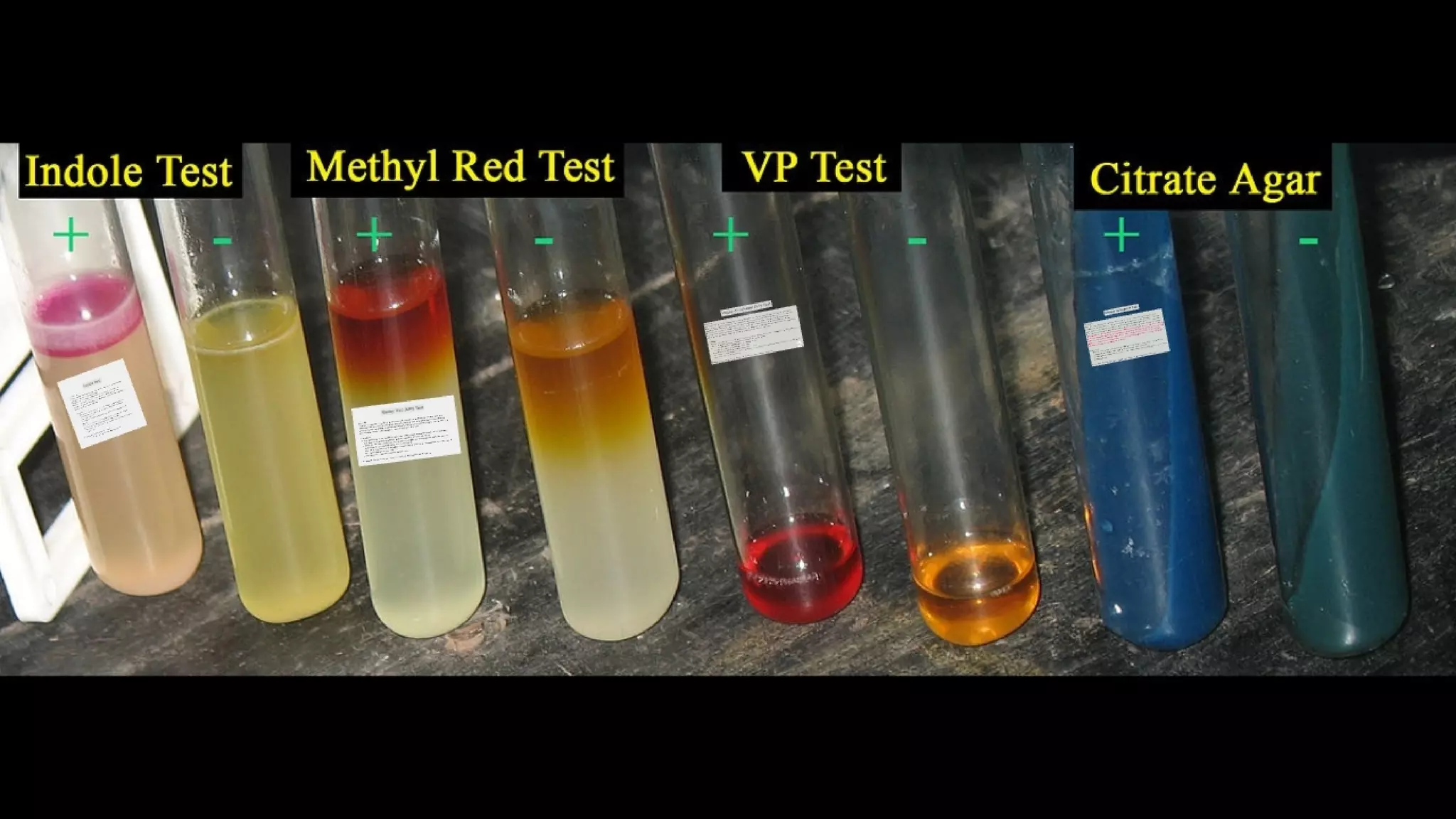 IMViC (Indole Methyl red Voges prascuer Citrate) Test | PDF