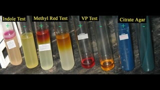 IMViC (Indole Methyl red Voges prascuer Citrate)  Test