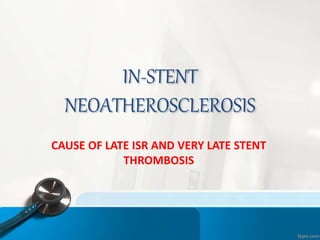 IN-STENT
NEOATHEROSCLEROSIS
CAUSE OF LATE ISR AND VERY LATE STENT
THROMBOSIS
 