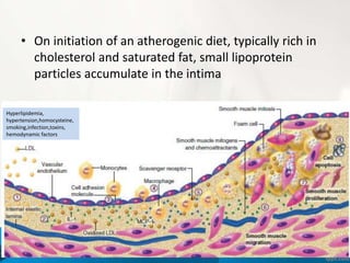 • On initiation of an atherogenic diet, typically rich in
cholesterol and saturated fat, small lipoprotein
particles accumulate in the intima
Hyperlipidemia,
hypertension,homocysteine,
smoking,infection,toxins,
hemodynamic factors
 