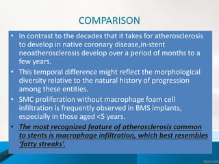 COMPARISON
• In contrast to the decades that it takes for atherosclerosis
to develop in native coronary disease,in-stent
neoatherosclerosis develop over a period of months to a
few years.
• This temporal difference might reflect the morphological
diversity relative to the natural history of progression
among these entities.
• SMC proliferation without macrophage foam cell
infiltration is frequently observed in BMS implants,
especially in those aged <5 years.
• The most recognized feature of atherosclerosis common
to stents is macrophage infiltration, which best resembles
‘fatty streaks’.
 