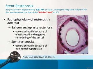 Stent Restenosis -
(ISR) occurred in approximately 20%-30% of cases ,causing the long-term failure of PCI
that was bestowed the title of the “Achilles’ heel” of PCI.
• Pathophysiology of restenosis is
different
– Balloon angioplasty restenosis:
• occurs primarily because of
elastic recoil and negative
remodeling of the vessel
– Stent restenosis:
• occurs primarily because of
neointimal hyperplasia
Cutlip et al. JACC 2002; 40:2082-9
 