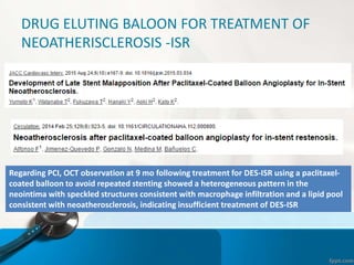DRUG ELUTING BALOON FOR TREATMENT OF
NEOATHERISCLEROSIS -ISR
Regarding PCI, OCT observation at 9 mo following treatment for DES-ISR using a paclitaxel-
coated balloon to avoid repeated stenting showed a heterogeneous pattern in the
neointima with speckled structures consistent with macrophage infiltration and a lipid pool
consistent with neoatherosclerosis, indicating insufficient treatment of DES-ISR
 