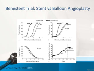 Benestent Trial: Stent vs Balloon Angioplasty
Serruys PW et al. N Engl J Med 1994;331:489-495.
 