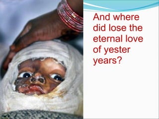 And where did lose the eternal love of yester years? 