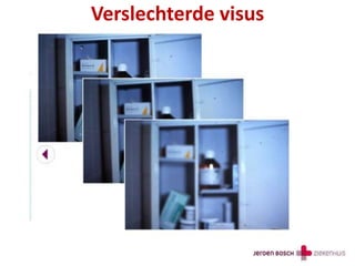 Verslechterde visus
 