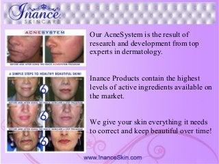 Our AcneSystem is the result of
research and development from top
experts in dermatology.
Inance Products contain the highest
levels of active ingredients available on
the market.
We give your skin everything it needs
to correct and keep beautiful over time!
 