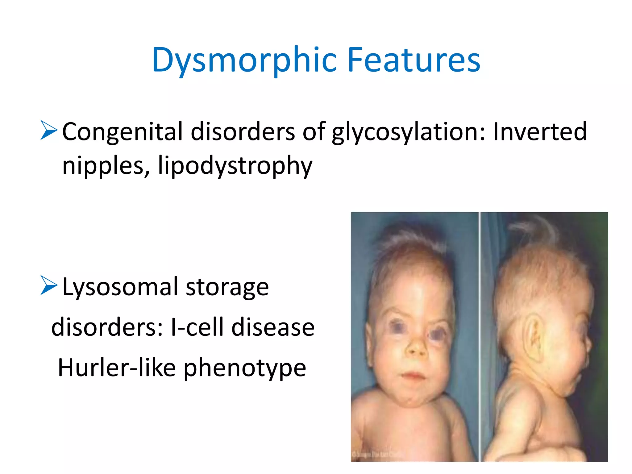approach to Inborn Errors of Metabolism in neonates | PPTX