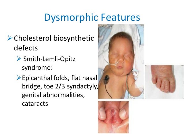 approach to Inborn Errors of Metabolism in neonates