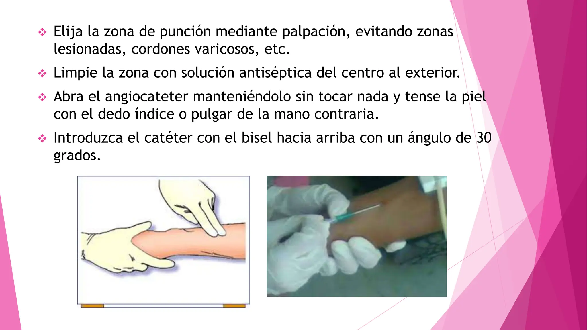  Elija la zona de punción mediante palpación, evitando zonas
lesionadas, cordones varicosos, etc.
 Limpie la zona con solución antiséptica del centro al exterior.
 Abra el angiocateter manteniéndolo sin tocar nada y tense la piel
con el dedo índice o pulgar de la mano contraria.
 Introduzca el catéter con el bisel hacia arriba con un ángulo de 30
grados.
 